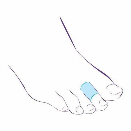 Напальчник Тривес СТ-45 от мозолей и натоптышей, силиконовый, 2 шт Напальчник Тривес СТ-45 от мозолей и натоптышей, силиконовый, 2 шт