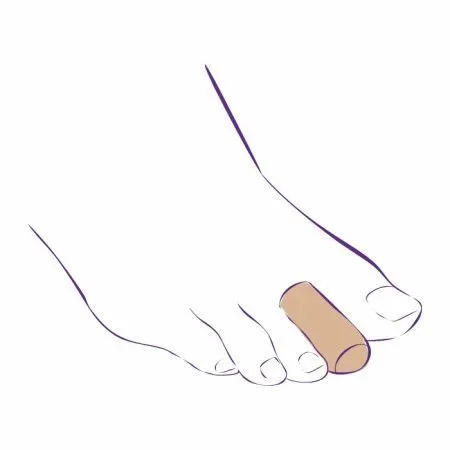 Напальчник Тривес СТ-66 от мозолей и натоптышей, тканевый с гелевым покрытием внутри, 2 шт Напальчник Тривес СТ-66 от мозолей и натоптышей, тканевый с гелевым покрытием внутри, 2 шт