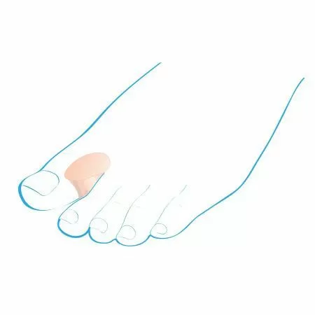 Разделитель межпальцевый Крейт С-400 силиконовый, 2 шт Разделитель межпальцевый Крейт С-400 силиконовый, 2 шт