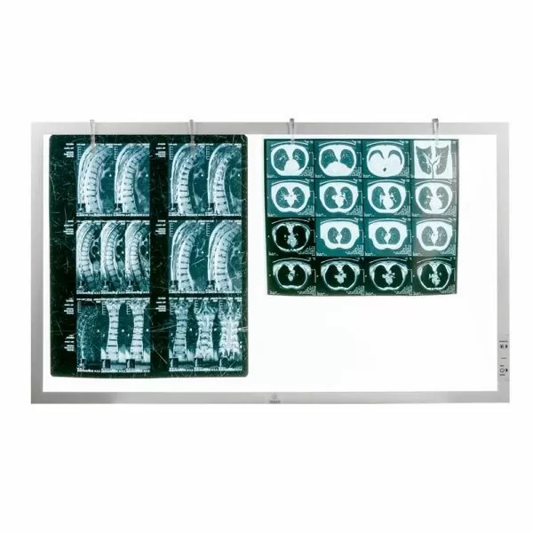 Негатоскоп TAGLER НСД-2 2-кадровый светодиодный Негатоскоп TAGLER НСД-2 2-кадровый светодиодный