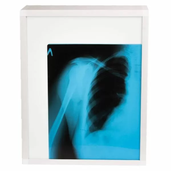 Негатоскоп TAGLER НЛ-1 1-кадровый  Негатоскоп TAGLER НЛ-1 1-кадровый