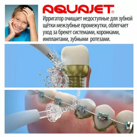 Ирригатор портативный Little Doctor LD A3 серый, зарядка от USB, любая емкость для воды Ирригатор портативный Little Doctor LD A3 серый, зарядка от USB, любая емкость для воды
