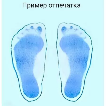 Плантограф TAGLER для определения плоскостопия Плантограф TAGLER для определения плоскостопия