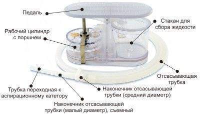 Аспиратор портативный с механическим приводом Медплант АПМ-МП-1 артикул 698 Аспиратор портативный с механическим приводом Медплант АПМ-МП-1 артикул 698