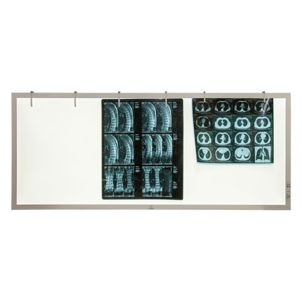 Негатоскоп TAGLER НСД-3 3-кадровый светодиодный