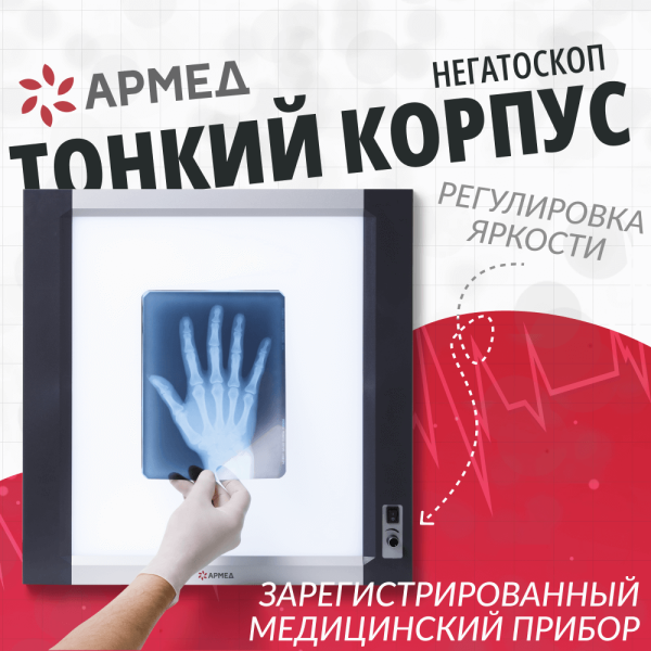 Негатоскоп общего назначения Армед 1-кадровый LUX Негатоскоп общего назначения Армед 1-кадровый LUX